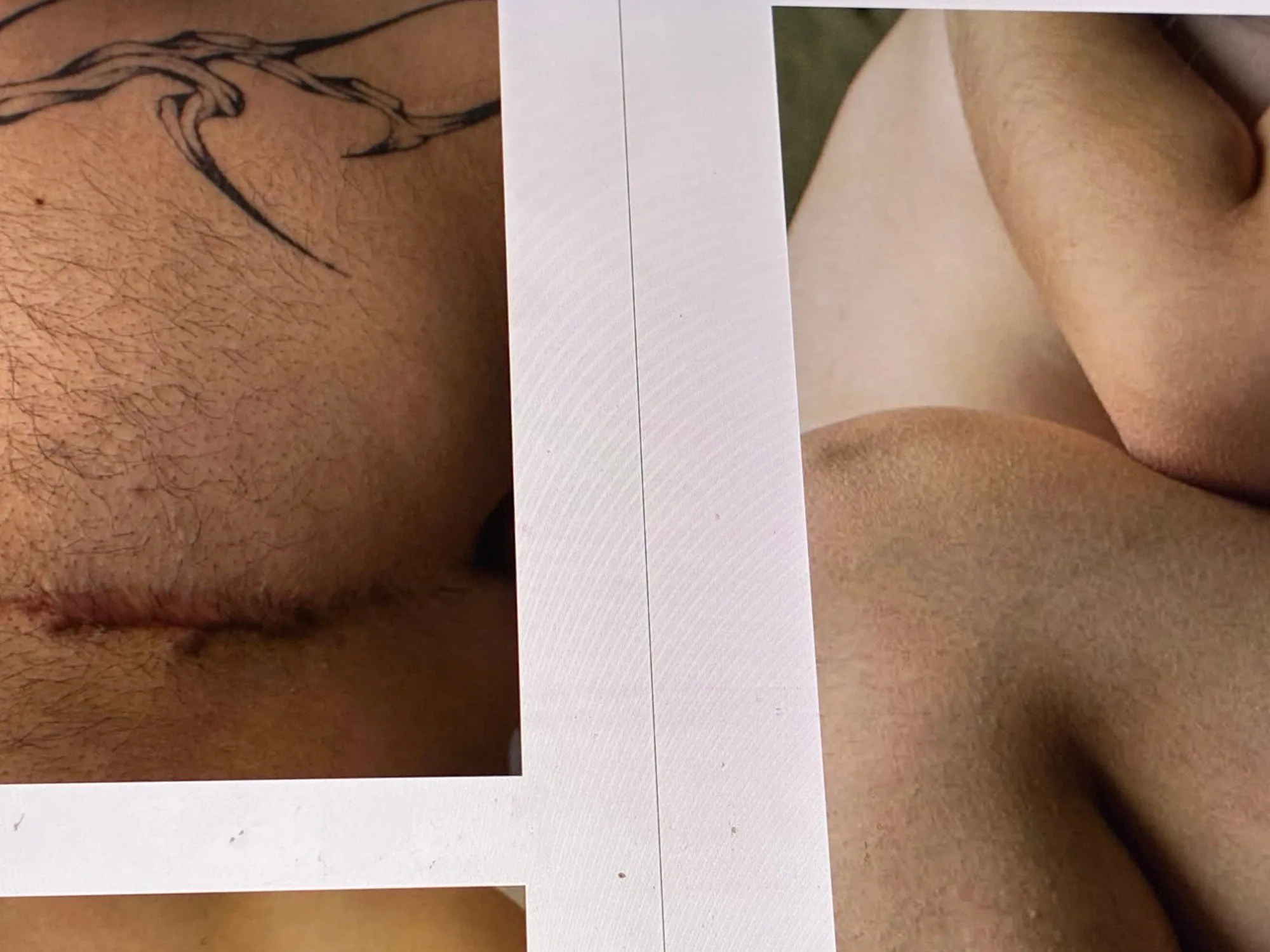 Collage of close-up skin photographs showing a vine tattoo, a scar, and arms folded together